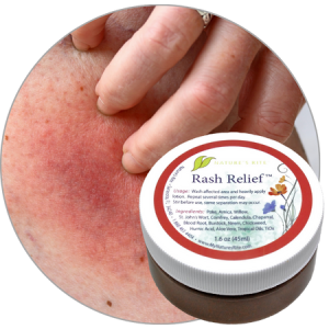 Rash Relief